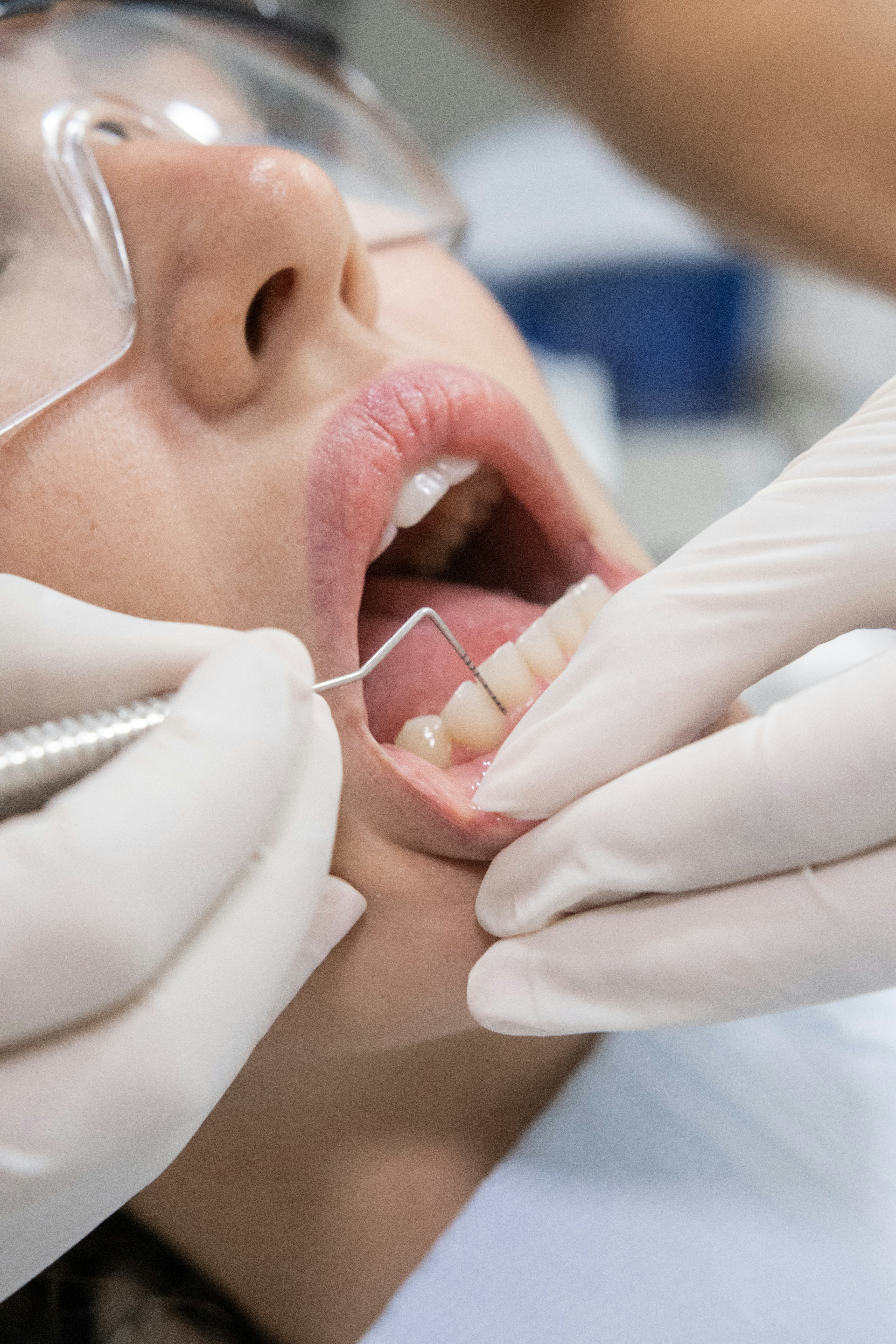 cosmetic-dental reference frame 1