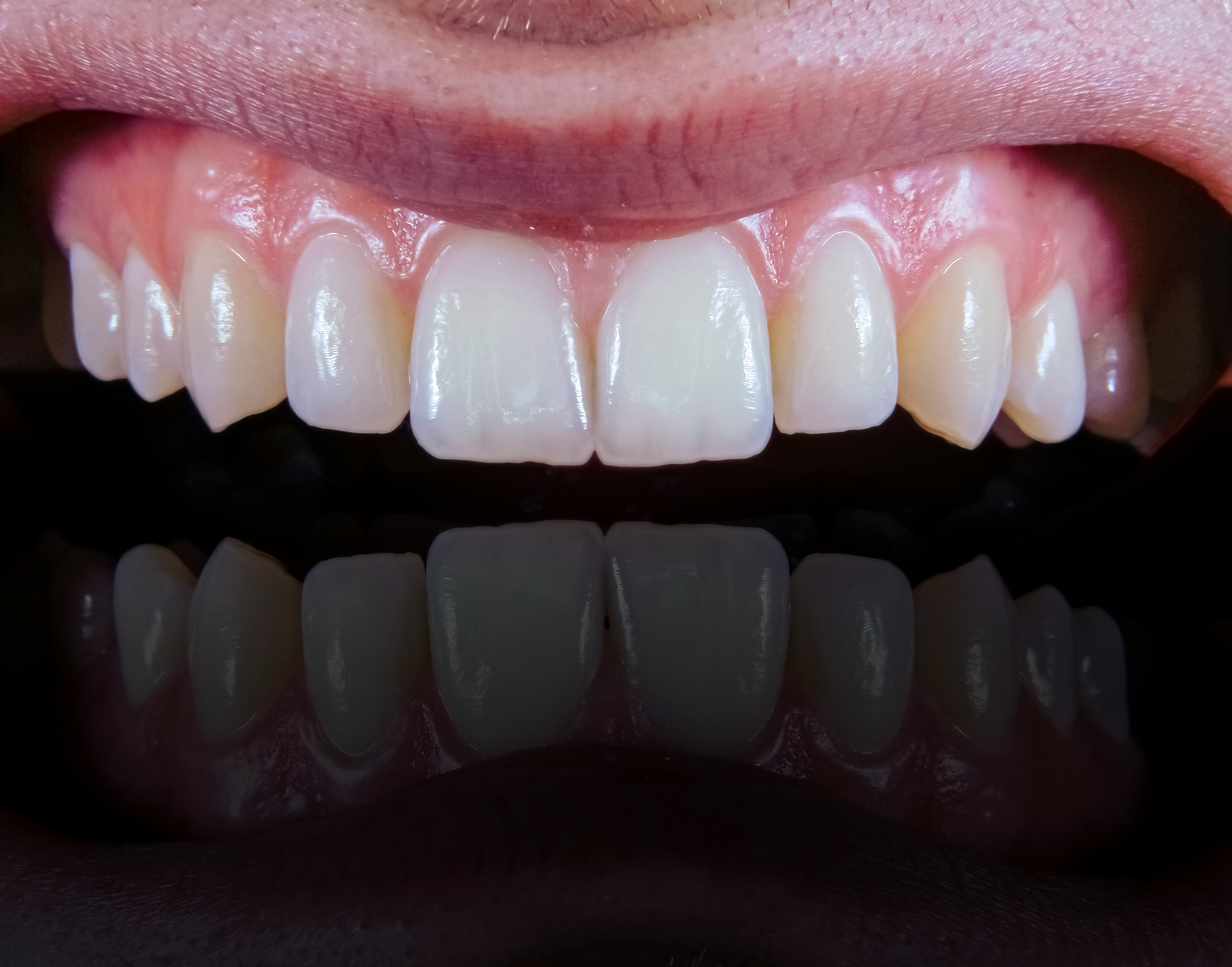 dental reference frame 2